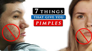Entdecke rezepte, einrichtungsideen, stilinterpretationen und andere ideen zum ausprobieren. What Causes Pimples On Your Face And How To Get Rid Of It Youtube