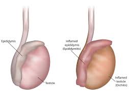 Image result for Scrotum