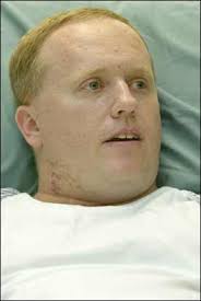 Civilian shot in Kuwait says ordeal underlines need for anti-terror drive