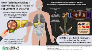 A single lobule is about the size of a sesame seed and is roughly hexagonal in shape. Quantitative Detection Of Fatty Liver Disease By Assessing Fat Distribution In The Liver Eurekalert Science News