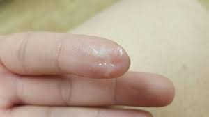 After ovulating, your vaginal secretions can look creamy, egg whitish, thick or even yellow. Watery Discharge After Ovulation Glow Community