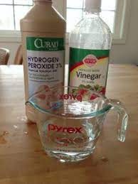 How To Get Rid Of A Rash Under Your Wedding Rings Ring Cleaner Cleaning Jewelry Wedding Ring Rash