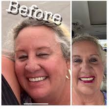 I'm debating whether to get the surgery, my eyes have always been hooded  but as I've aged (42) it's got worse, do you think I would be a good  candidate? I'm worried