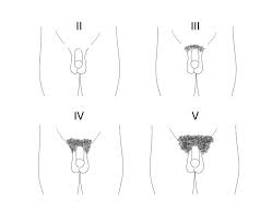 Physical Growth And Sexual Maturation Of Adolescents