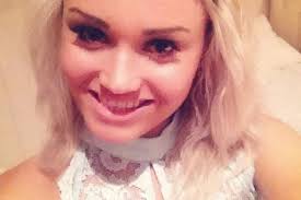 Girl (23) bullied due to eczema becomes top beauty queen