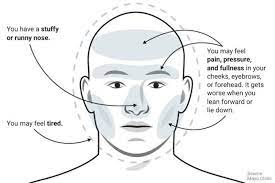 Maybe you would like to learn more about one of these? Migrain Dan Sakit Kepala Tahukah Bedanya Halaman All Kompas Com