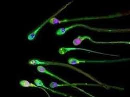 Cos'è e come si fa. Spermiogramma Computerizzato Artemisia Lab