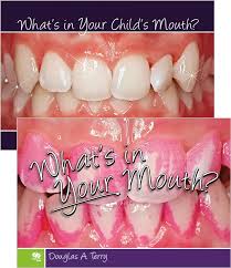 Therefore, its functional efficiency is important for your market reputation. Douglas A Terry Willi Geller Esthetic And Restorative Dentistry Quintessence Publishing Company Ltd