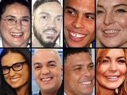 Share facebook share twitter share whatsapp+ open share. Compare Os Dentes Dos Famosos Antes E Depois Da Fama Fotos R7 Hoje Em Dia
