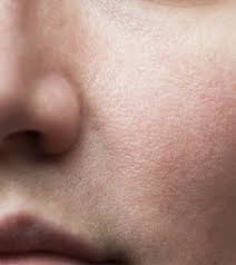 Sekarang, saya akan mengungkapkan beberapa kegunaan lidah buaya untuk pemutihan kulit yang bisa kamu terapkan pada kenyamanan, jadi jika kamu ingin menemukan lidah buaya yang menakjubkan dan dapat membantu kamu memutikan secara alami. Manfaat Masker Lidah Buaya Untuk Kecantikan Portal Wanita Muda