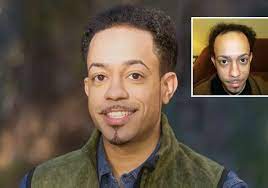 We did not find results for: Non Surgical Hair Replacement Hair Replacement Options Hair Club