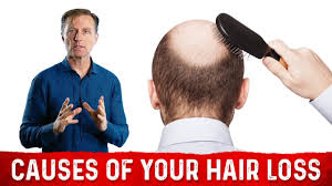 I was prescribed adderall in the aug of �05. The Causes Of Hair Loss Dr Berg Blog