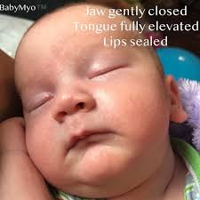 Tongue Tie & Infant Feeding Lynette Beard