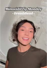 Minoxidil Tip Monday!! 🫶🏼✨- Dreadshed!! Lasts 2-8 weeks and is a sign  it’s working (still very scary though) #minoxidil #hairtransformation  #hairlosssolutions #minoxidilapplication #hairlossremedy