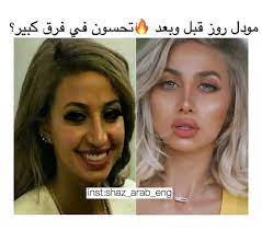 حقيقة فضيحة مودل روز قبل بعد عملية التجميل الصفحة العربية. Facebook