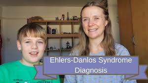 Symptoms include varying degrees of hyperextensive skin. Ehlers Danlos Syndrome Diagnosis 2019 Youtube