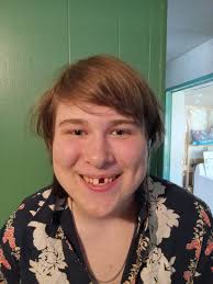 Does the missing tooth make him look like Alfred?