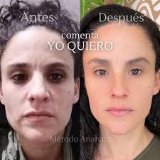 Tres tips para un rejuvenecimiento que buscas! Hoy te comparto mis mejores  consejos para lograr un rejuvenecimiento natural y duradero. ¡Aprende y  aplica estos tips para ver resultados increíbles! 🧏🏻‍♀️ ¿Qué tip