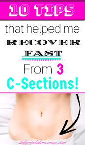 C Section Recovery Tips Italianpolishmomma Com C Section Recovery C Section C Section Recovery Timeline
