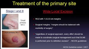 Image supplied by bob rossborough. Update In Medical Treatment Of Merkel Cell Carcinoma Youtube