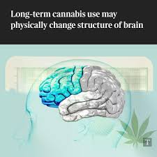 Daily cannabis use may alter the structures of the brain linked to decision-making and planning, a study has suggested. Cannabis is often viewed as low-risk or harmless by casual and recreational users