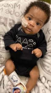 Infant born with end stage renal disease passes away, family thanks  community for help