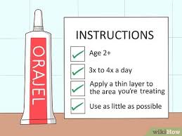 Oragel mouth, provides rapid relief of mouth ulcers and denture pain. Orajel Auftragen Wikihow