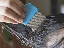 Head lice usually stay close to the scalp and behind the ears. 7 Common Lice Symptoms Do You Have Lice