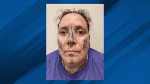 Albany Topic Legal proceedings