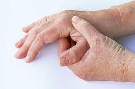 Neurodermitis an den händen neurodermitis kann verschiedene teile des körpers betreffen. Neurodermitis Erkennen Krankenhaus De