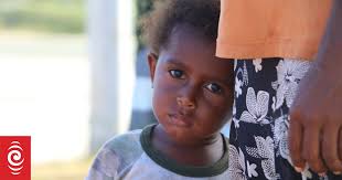 Aftershocks of Covid-19 threaten to undo gains across Pacific says report