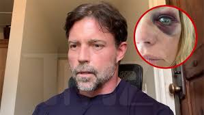 Denise Richards Seen With Apparent Black Eye After Visit to Estranged  Husband