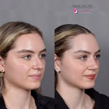 Nuance Aesthetics and Plastic Surgery