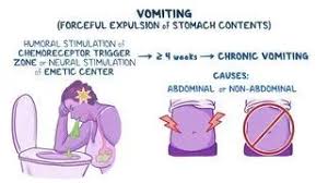 Image result for Chronic Functional Vomiting
