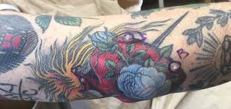 High quality professional artist tattoo supplies. Multiple Keratoacanthomas Arising Within Red Tattoo Pigment Mdedge Dermatology