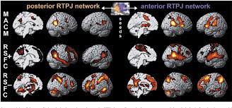 (2) tms has disrupted rtpj, but there were numerous brain regions and complex neural pathways involved in the process of moral judgment, thus reducing the degree of disruption from rtpj. Pdf Characterization Of The Temporo Parietal Junction By Combining Data Driven Parcellation Complementary Connectivity Analyses And Functional Decoding Semantic Scholar