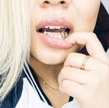 So, be careful while naming your business. Dental Regalia Rich Grillz Gold Silver Custom Grillz Dc Md And Va