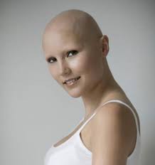 What is it like for a woman to lose her hair?