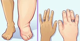 There are also other ways to reduce water retention which have been supported by anecdotal evidences and not have been widely studied. How To Reduce Water Retention Fast The Emerging India