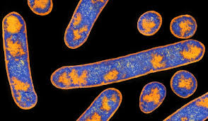 Maybe you would like to learn more about one of these? Clostridium Botulinum The Pandora Report