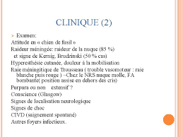 We did not find results for: Meningites Purulentes Introduction Mningites Purulentes Infection Des Mninges