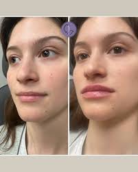 About Gina Bucherich, RN, BSN