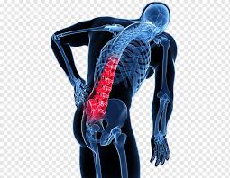 Lower back organ anatomy diagram : Neck Pain Back Pain Pain Management Medicine Others Medical Pain Anatomy Png Pngwing