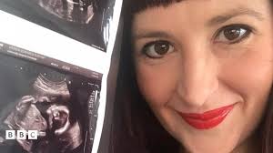 Y pryder sy'n wynebu menywod beichiog yn sgil y feirws