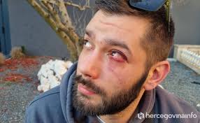 EKSKLUZIVNO ČETVORICA NA JEDNOGA Sin Rade Bošnjaka s trojicom batinaša u  Mostaru pretukao radnika Vinka Kojundžića