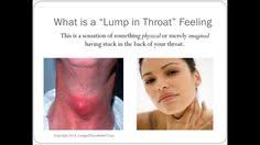 You're probably most familiar with strep throat the diagnosis is often confirmed by a rapid strep test, which can be done right in the doc's office. 9 Globus Ideas Lump In Throat Reflux Sensation