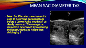 First Trimester Ultrasound Dr Muhammad Bin Zulfiqar