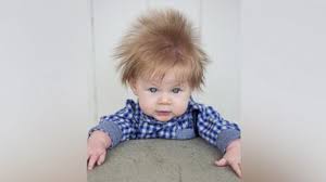 Brown hair is the second most common human hair color, after black hair. 5 Month Old Baby Boy S Wild Hair Is The Mane Event Abc News