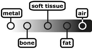 X Ray Ct Technique Startradiology