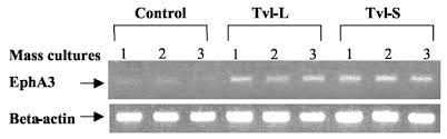 Tvi 24 is a tv channel from portugal. Differential Splicing Generates Tvl 1 Rfxank Isoforms With Different Functions Journal Of Biological Chemistry